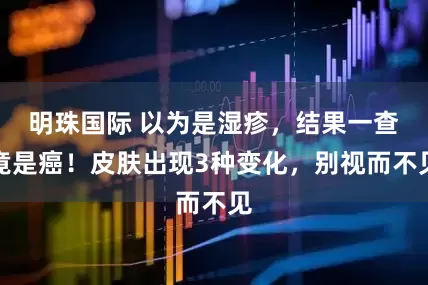 明珠国际 以为是湿疹，结果一查竟是癌！皮肤出现3种变化，别视而不见